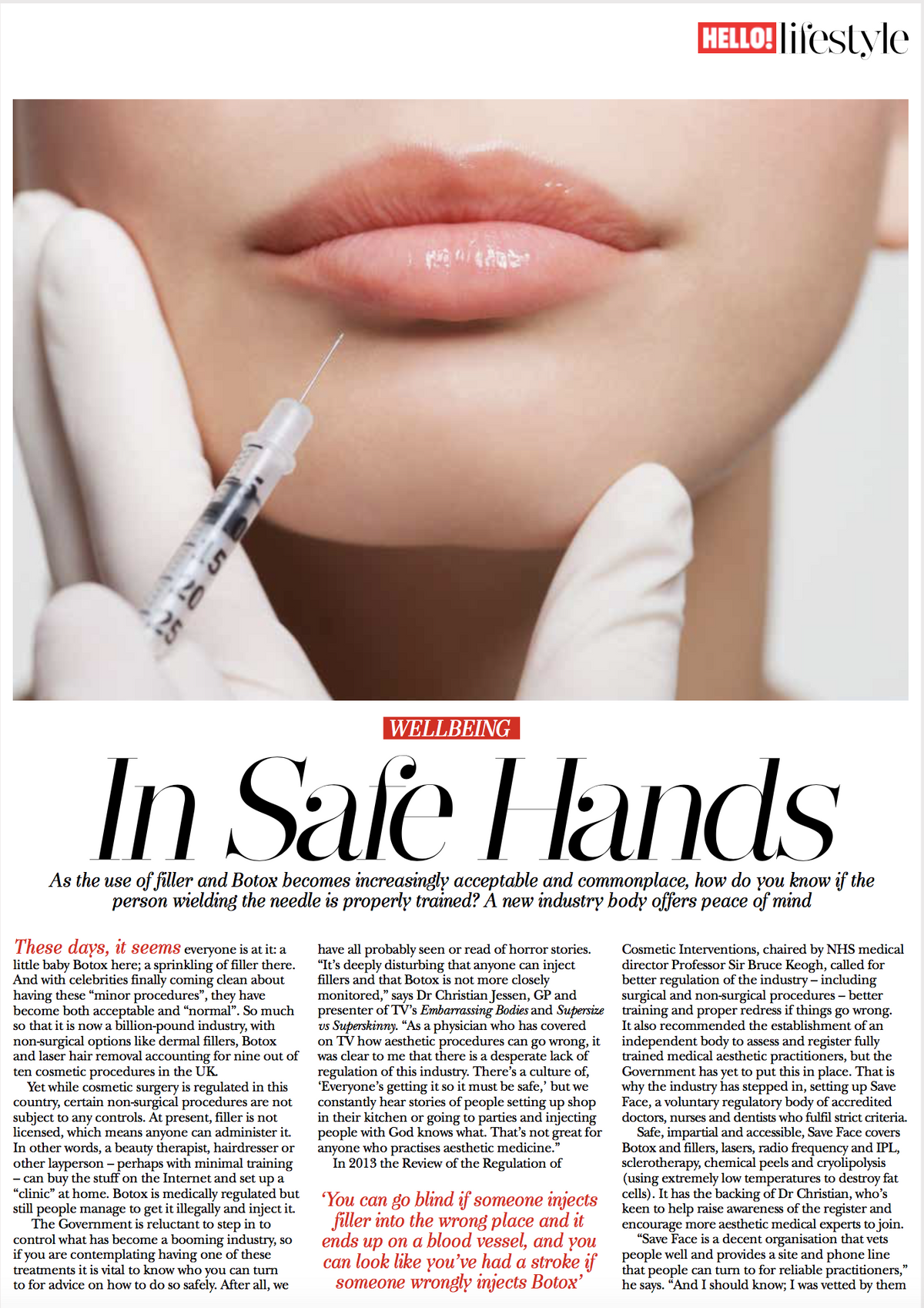 Hello Magazine writes about lip fillers